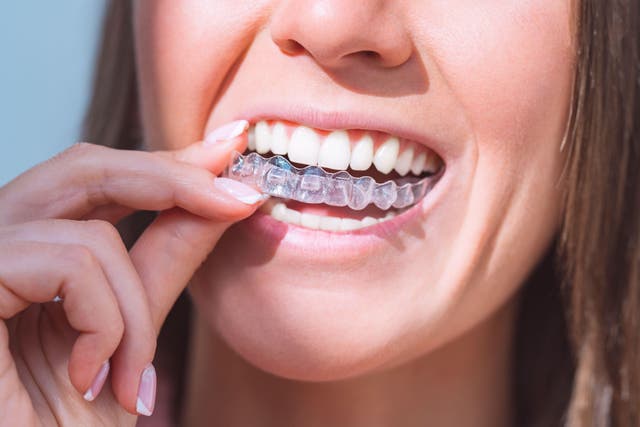 <p>Stock image of retainer-style braces </p>