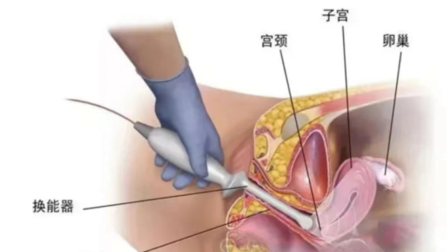 澳门四肖八码期期准免费公开的占卜预测,曾经很火但消失的女性手机,最新热门解答落实_静态版V2.29